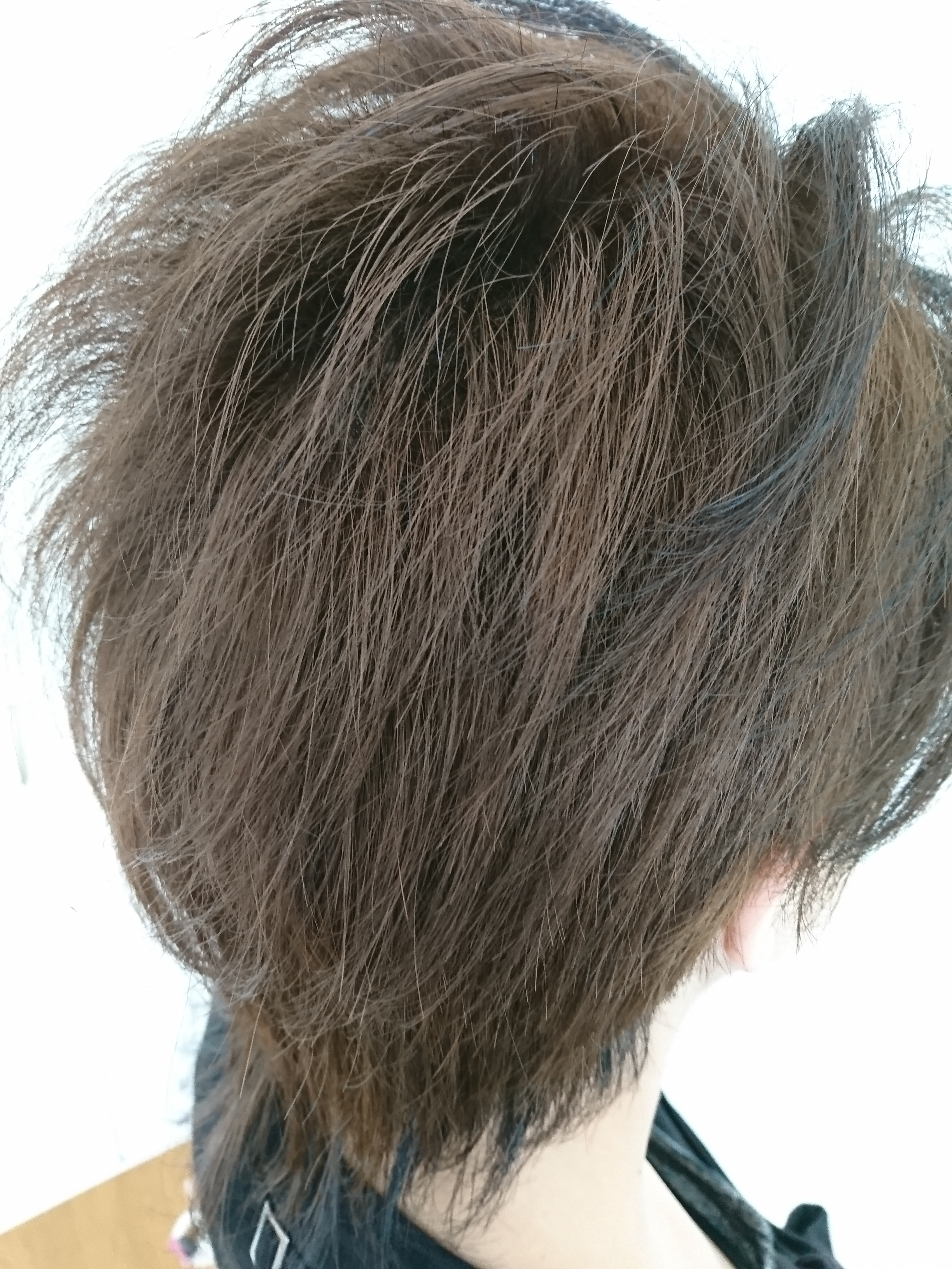 赤みが気になる方に